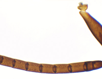 Antena de abeja, m.e.