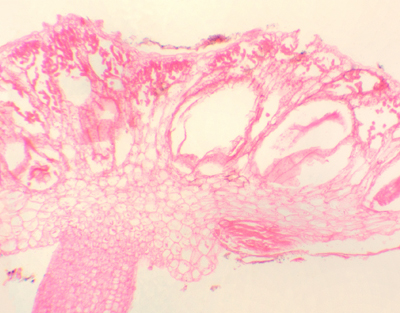 Anteridio de Marchantia, s.l.