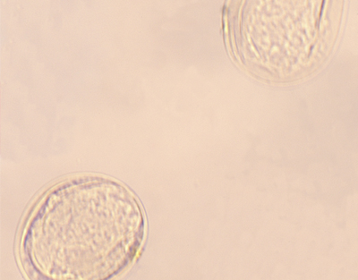 Oeufs de Schistosoma, s.e.