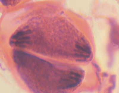 Meiosis, antera de lirio, s.t.