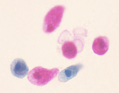 Amoeba proteus, m.e.