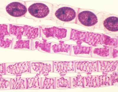 Conjugación de Spirogyra, m.e.