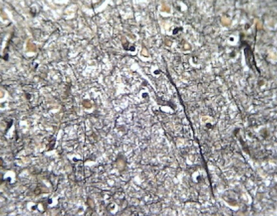 Cerebro humano, tinción plata, sec.