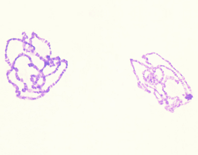 Cromosomas gigantes de glándula salival, m.e.