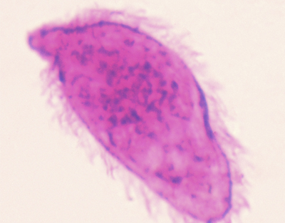 Miracidio de Schistosoma, m.e.
