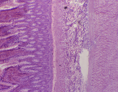 Intestino grueso, s.t.