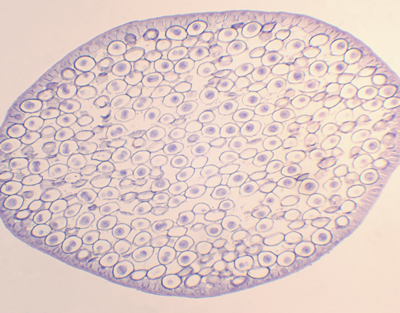 Mitosis en huevos de áscaris de caballo, sec.