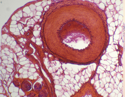 Arteria y vena, s.t.