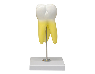 Molar superor c/3 raíces